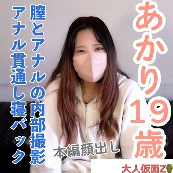 【素人初撮り・本編顔出し】あかり(19) 田舎住みのファミレスバイト。膣とアナルの内部撮影と中出し。吸うやつ入れたままおっぱい責め。アナルは貫通してそのまま寝バックで責めていきました。